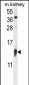 RPS12 Antibody (N-term)